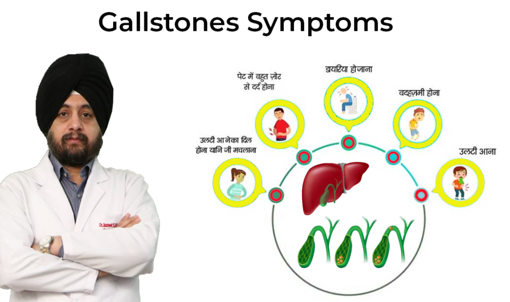 Gallstones Symptoms