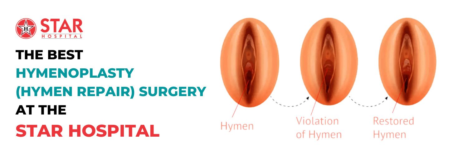 hymenoplasty