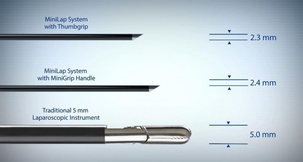 Mini Laparoscopic Surgery