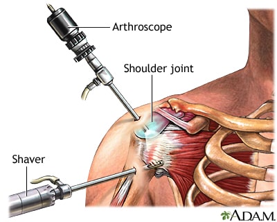 arthroscopic hospital in Jalandhar