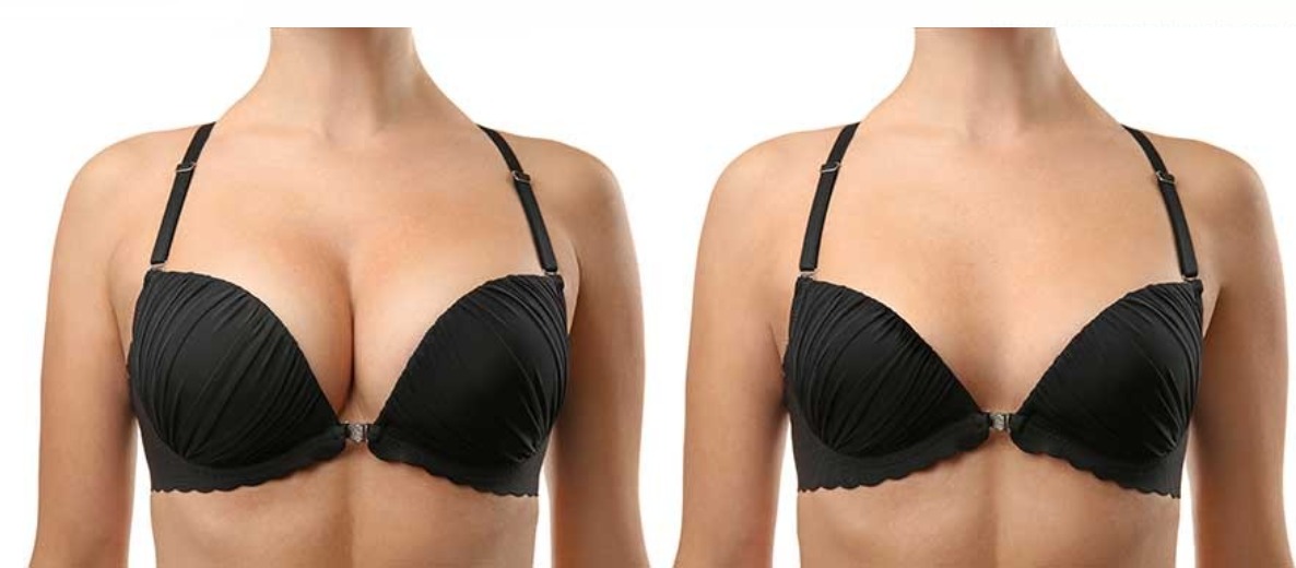 Best Breast Reduction Surgery In Jalandhar Cosmetic Surgery