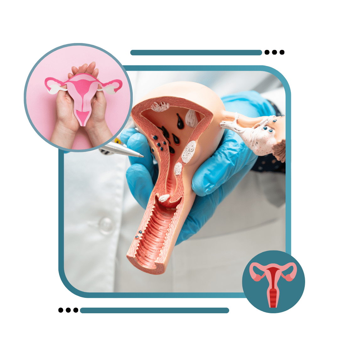 Cosmetic Gynecology Treatment in india