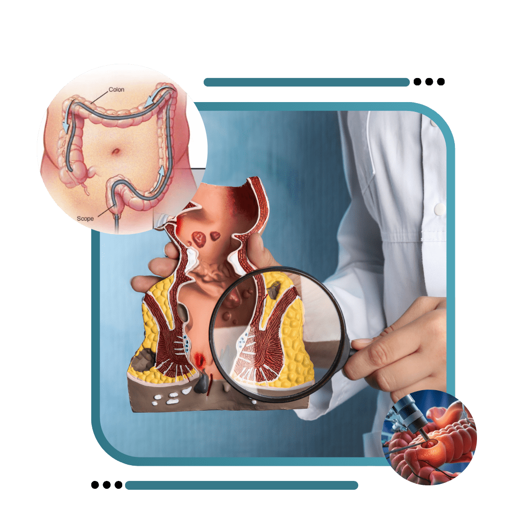 Best Colonoscopy Treatment In Jalandhar