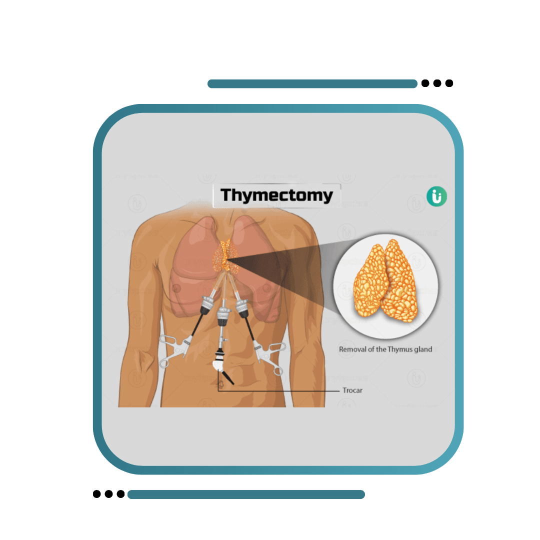 Best Thymectomy Surgery In Jalandhar