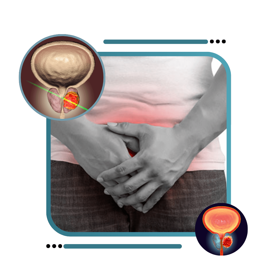 Urinary Bladder Stones In Jalandhar