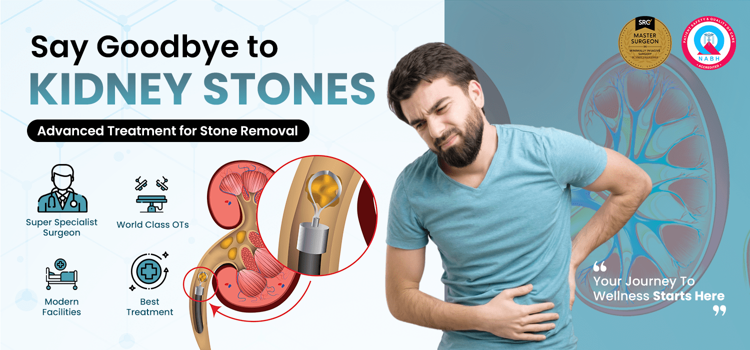 Kidney Stone Removal Jalandhar