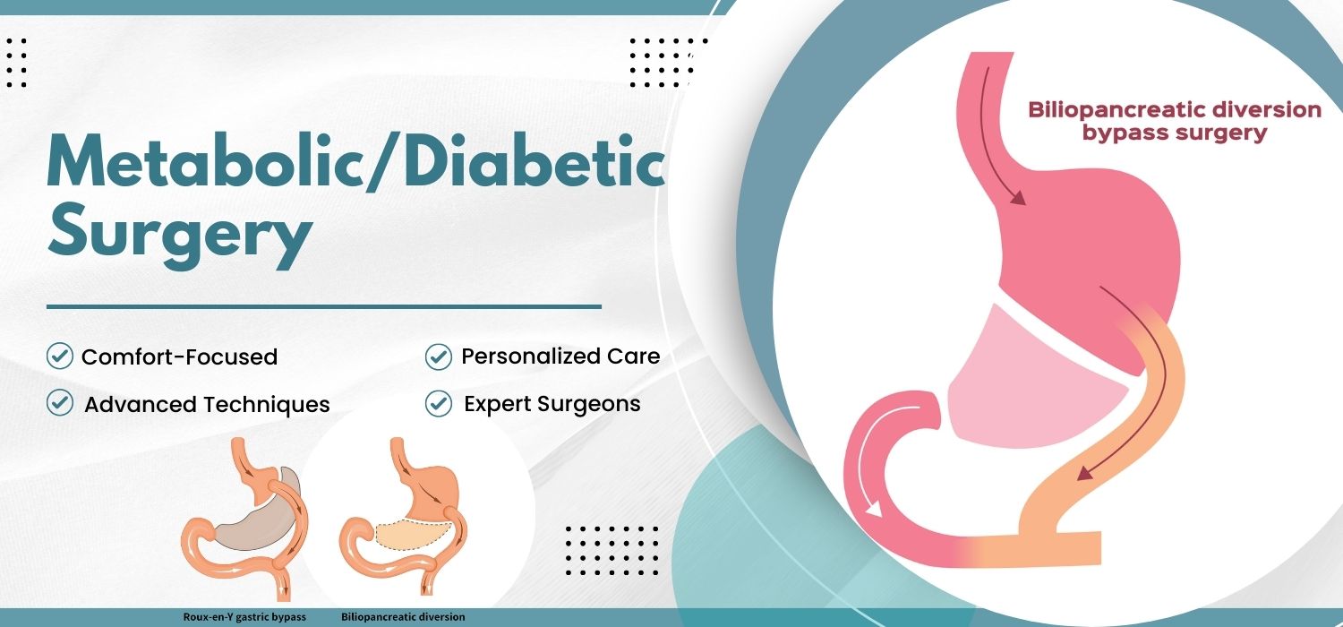 Metabolic / Diabetic Surgery Punjab