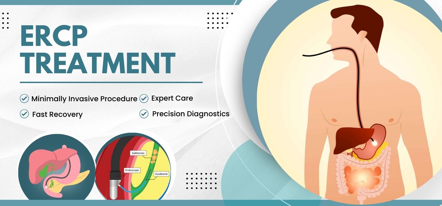 ERCP Treatment In Jalandhar