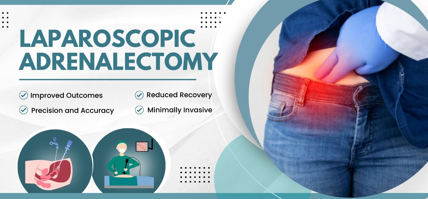 Laparoscopic Adrenalectomy Surgery In India