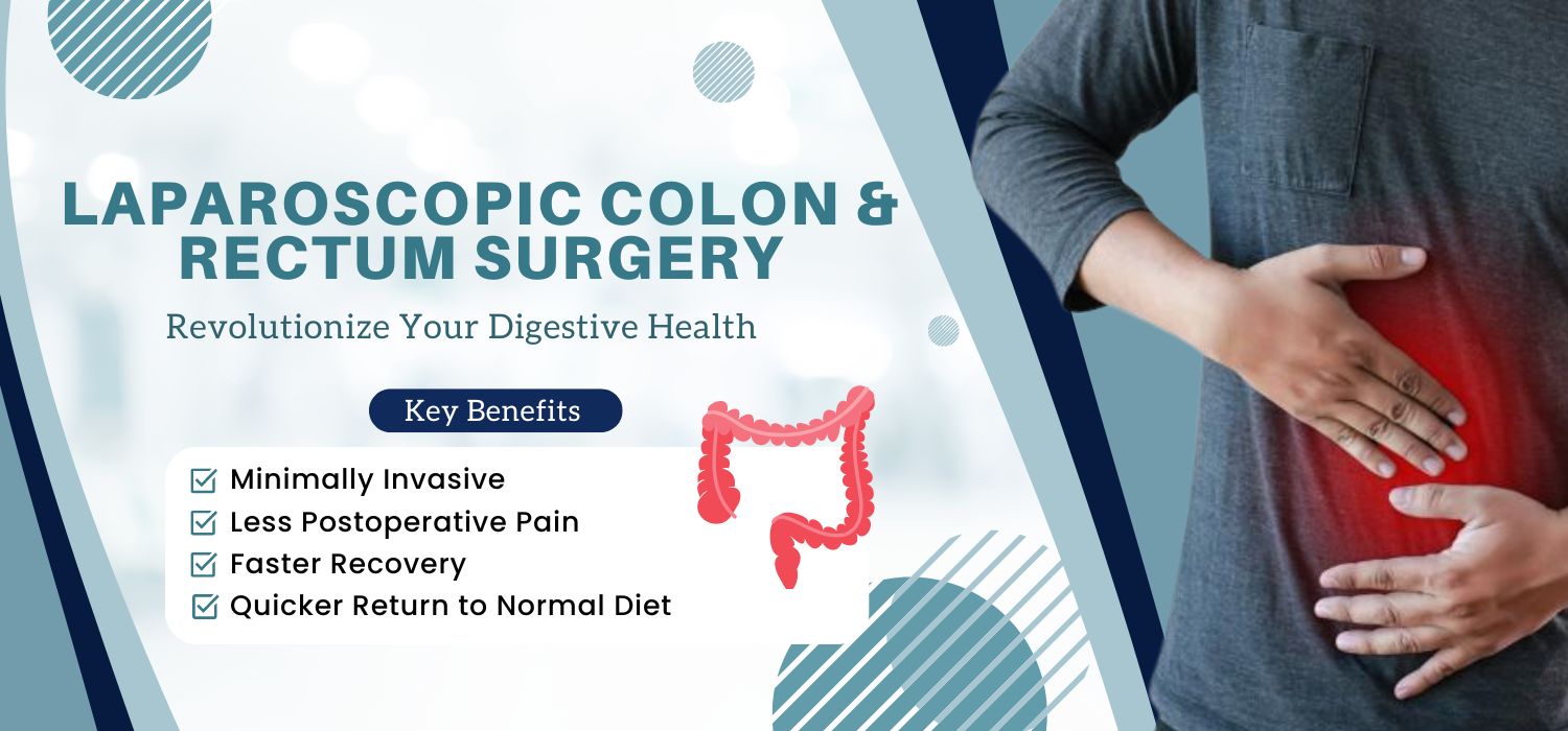 LAPAROSCOPIC COLON & RECTUM SURGERY IN JALANDHAR