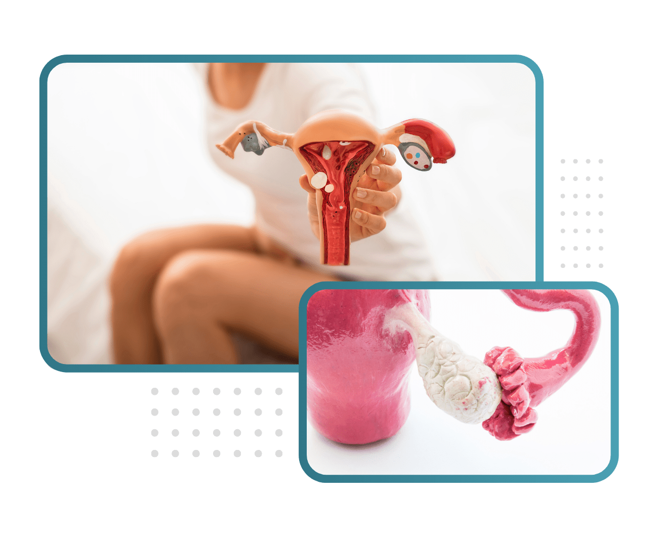 Ovarian Cyst Removal Surgery in Himachal Pradesh