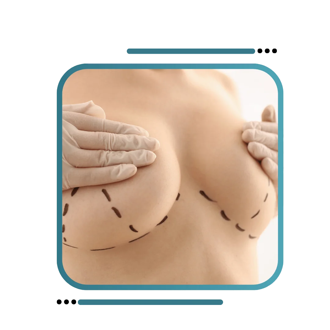 BEST BREAST ENLARGEMENT SURGERY IN JALANDHAR