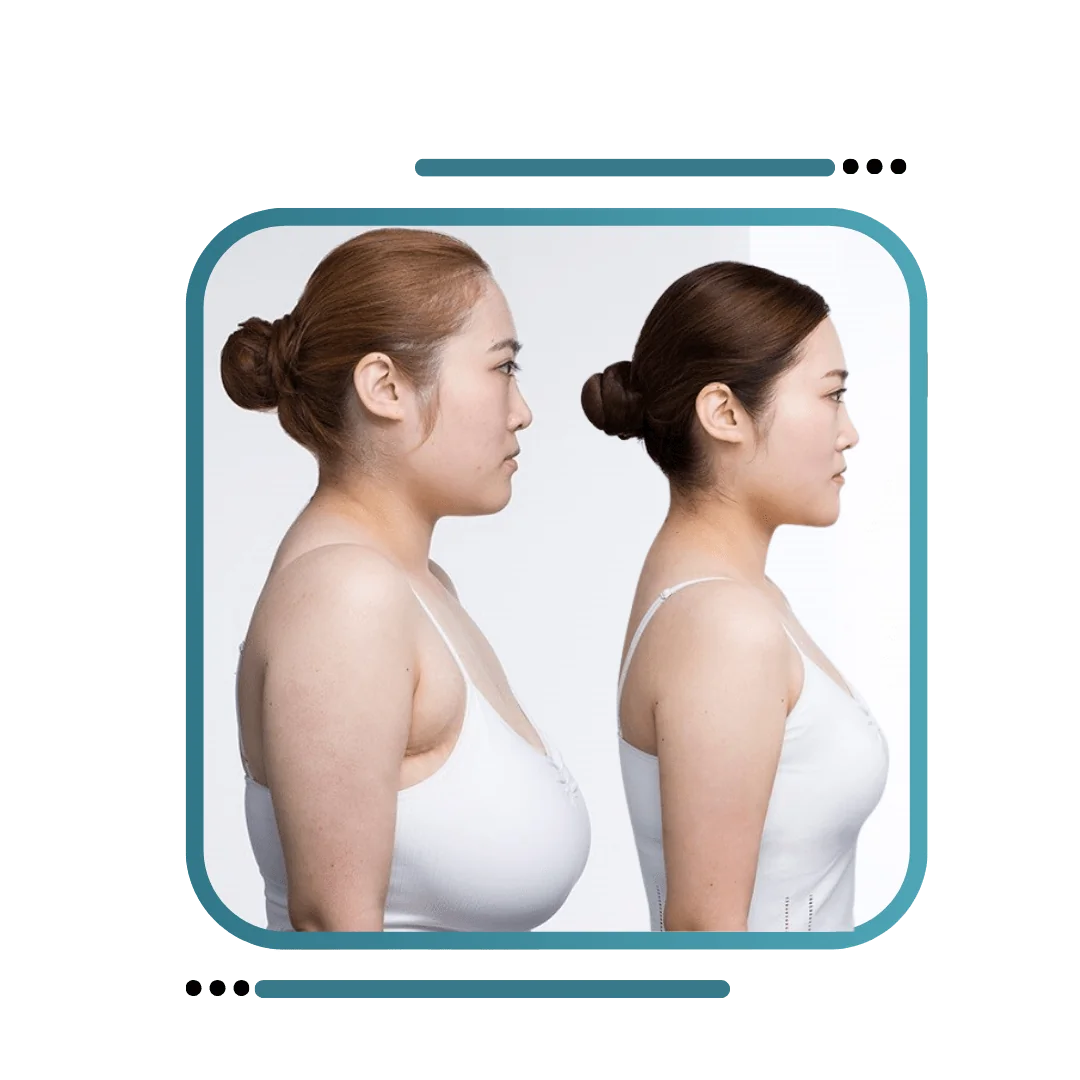 Best Breast Reduction Surgery In Jalandhar