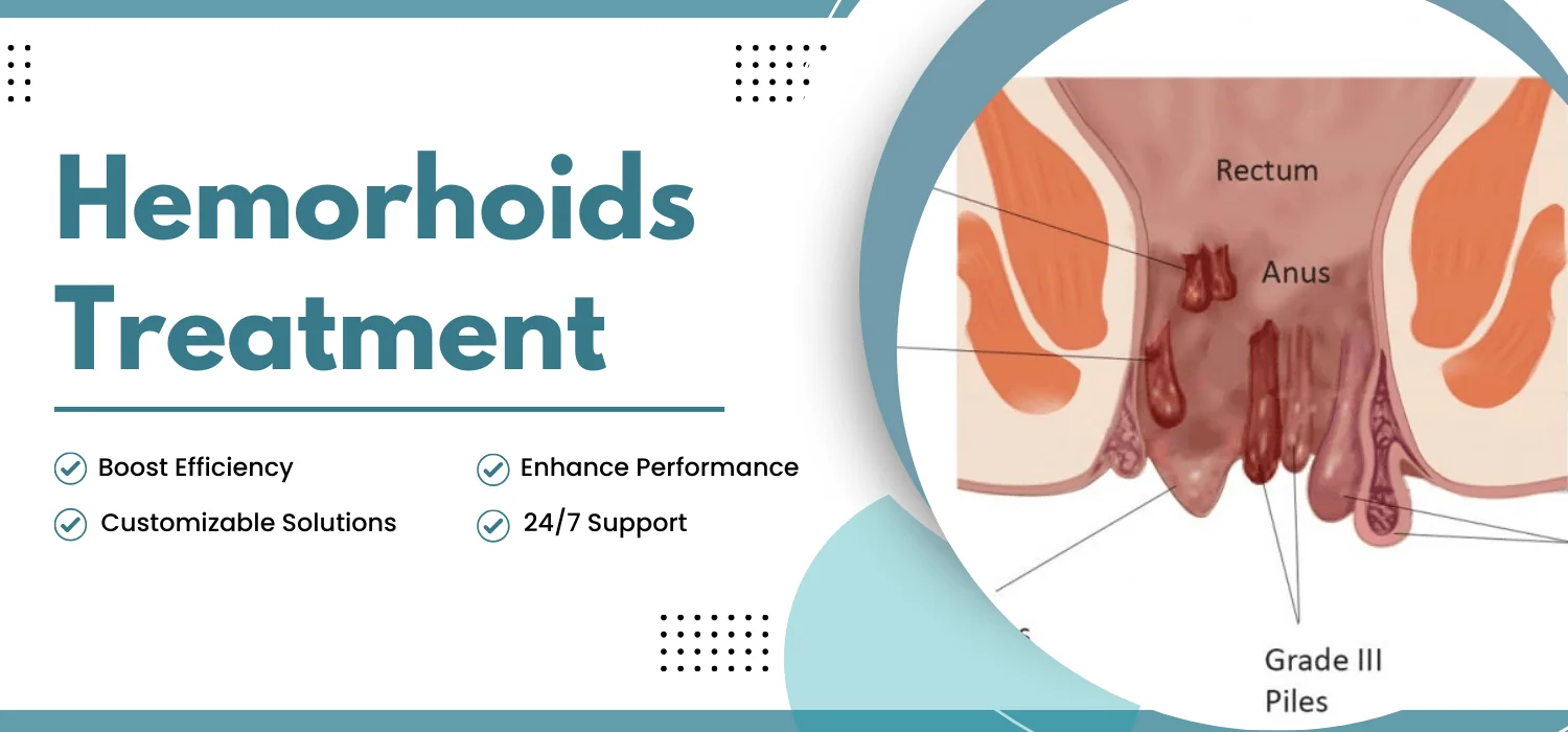 Best Hemorrhoids Treatment in Jalandhar