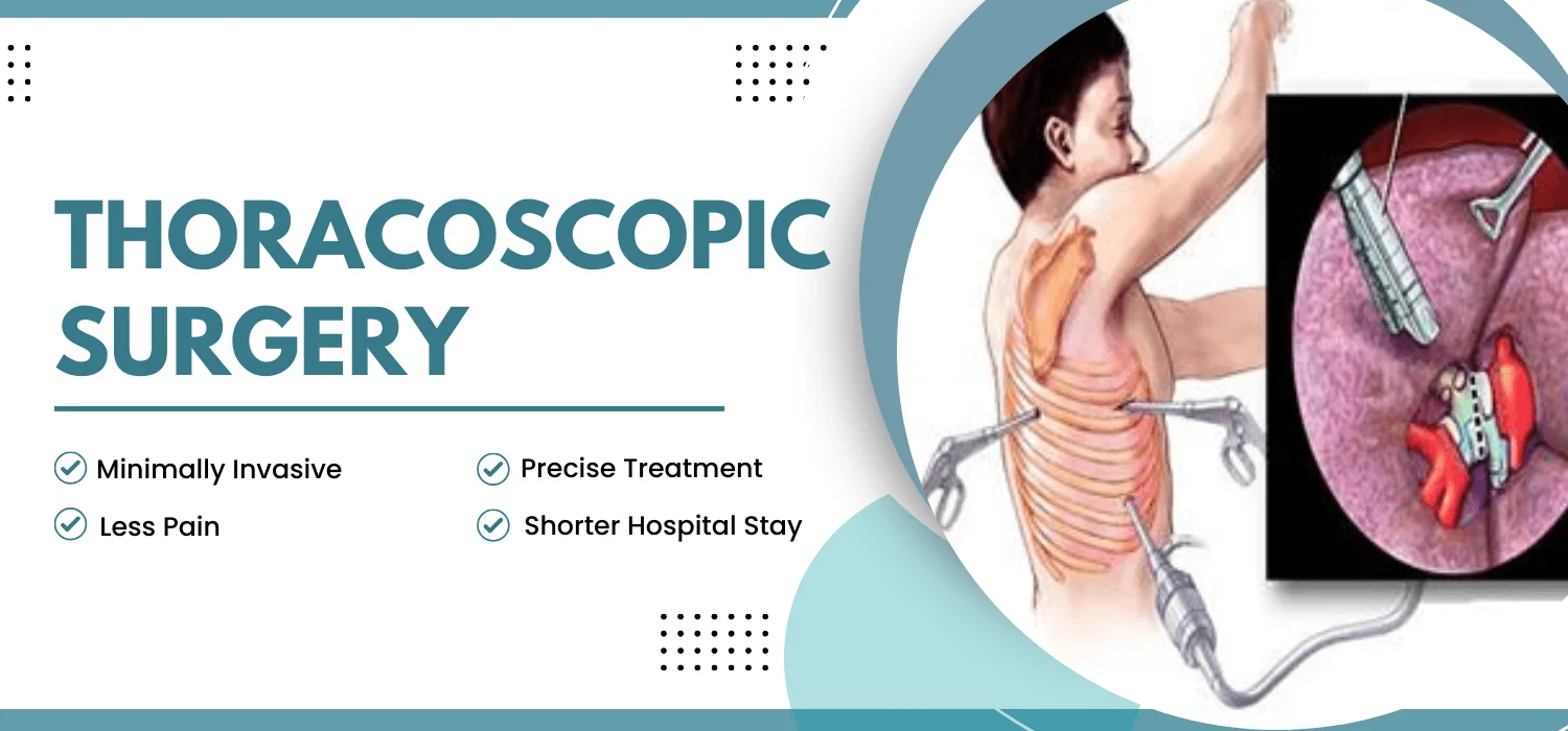 Thoracoscopic Surgery in Jalandhar