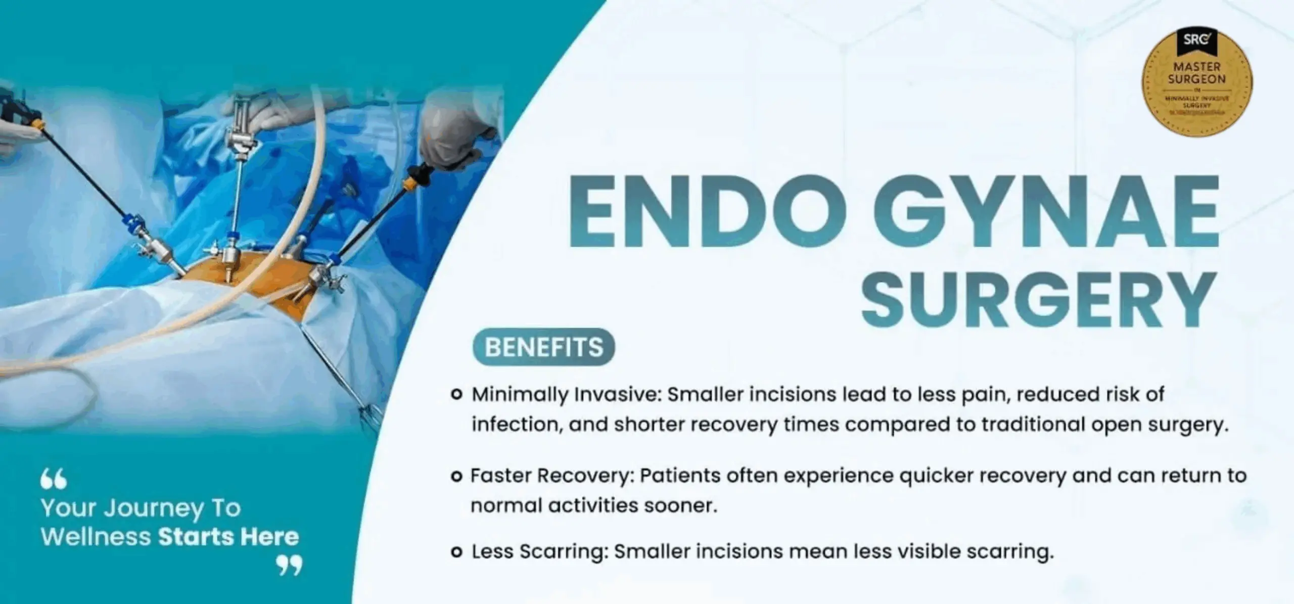 Endo Gynae Surgery in Jalandhar
