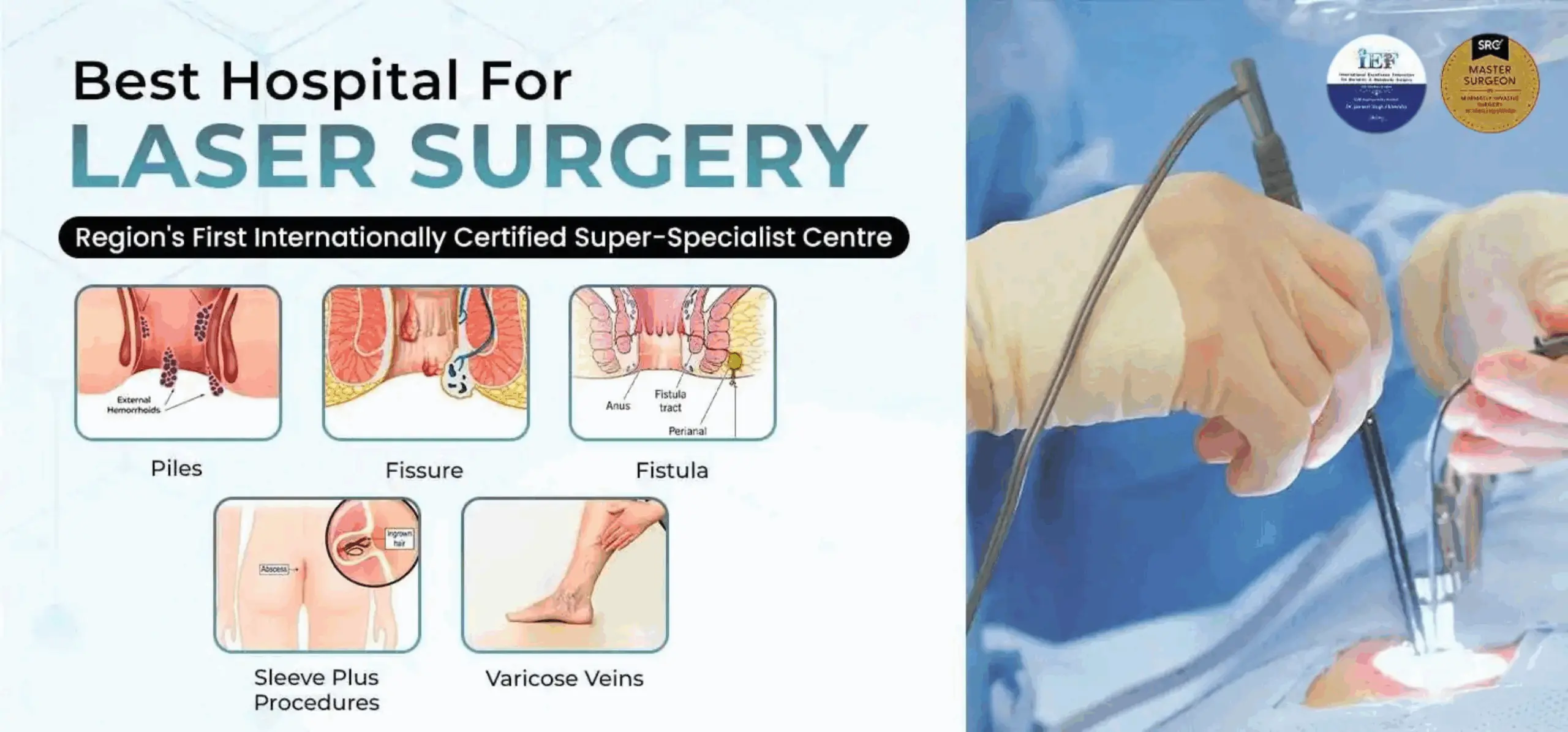 Fissure Surgery in Jalandhar