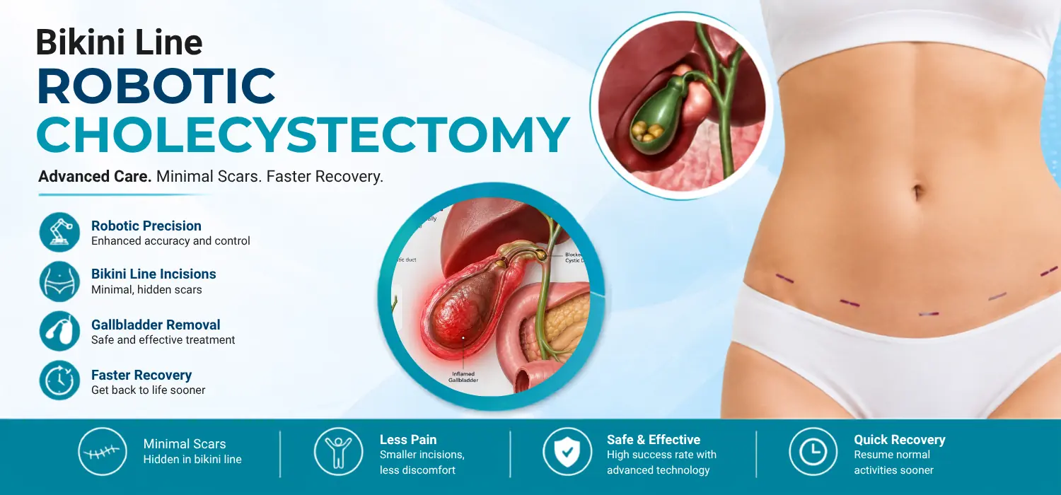 Bikini Line Robotic Cholecystectomy in Jalandhar