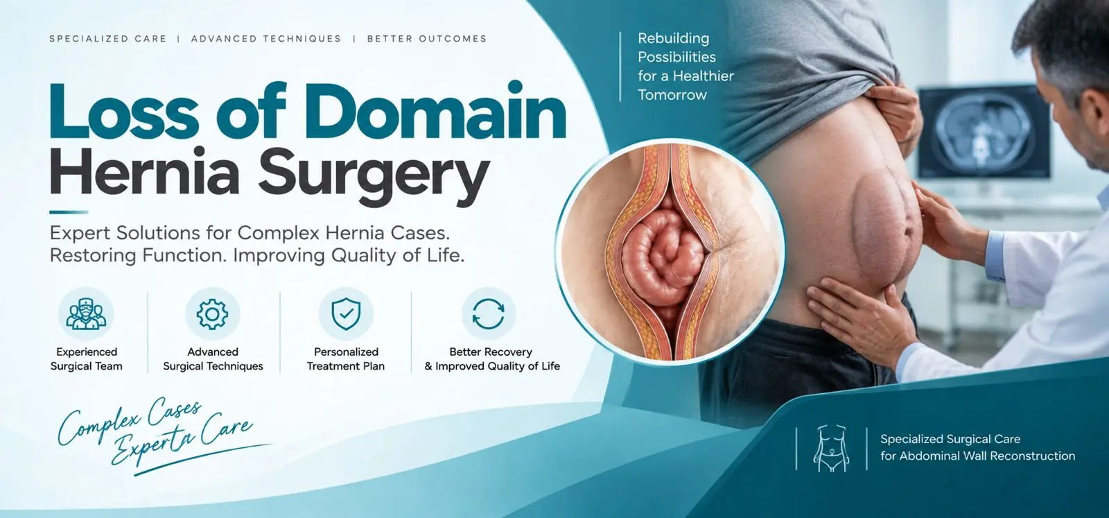 loss of domain hernia